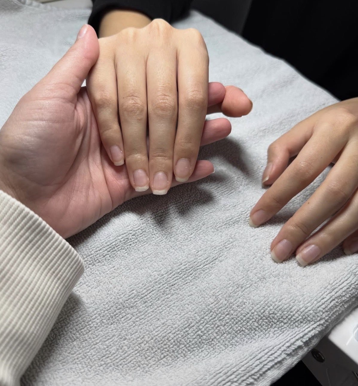 Avant : ongles naturels non manucurés